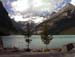LakeLouise1
